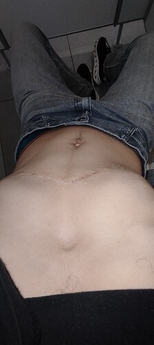 1000419505