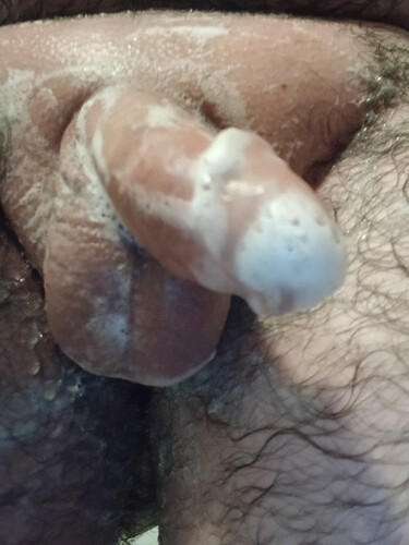 1000032293